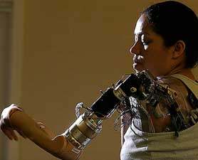 bionic-arm-moved-by-thought-676958-